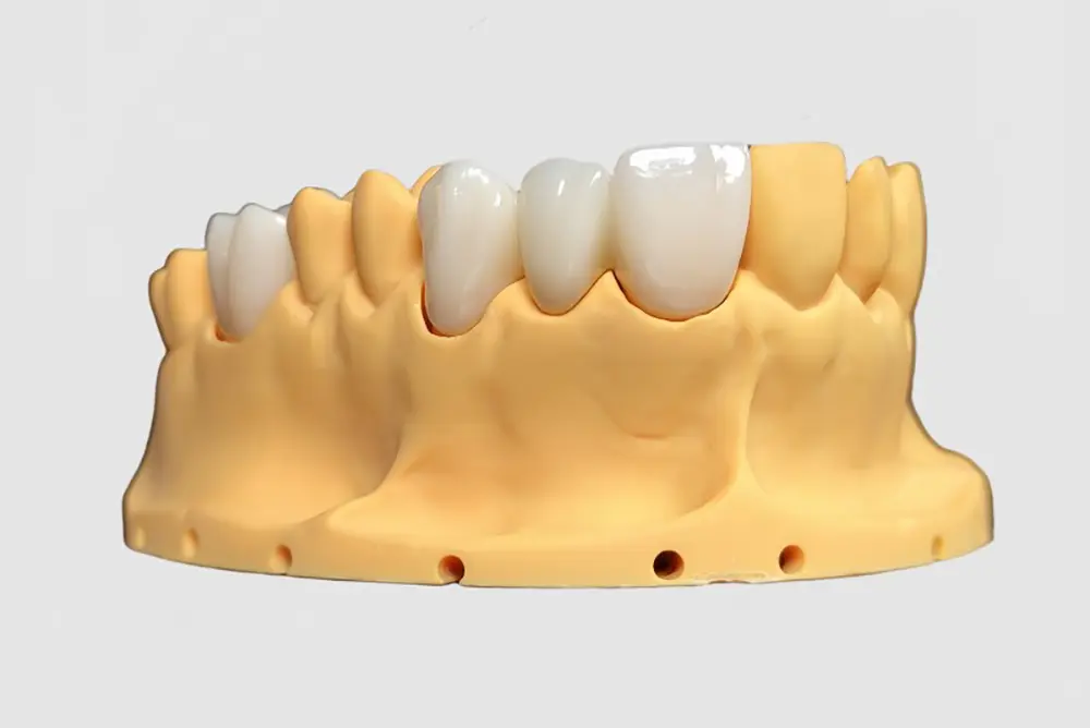 Full Zirconia (4).jpg