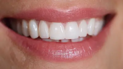 7 Best Benefits of Choosing Partial Dental Implants for Your Smile