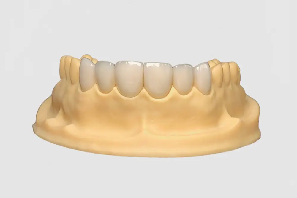 Full Zirconia (3).jpg