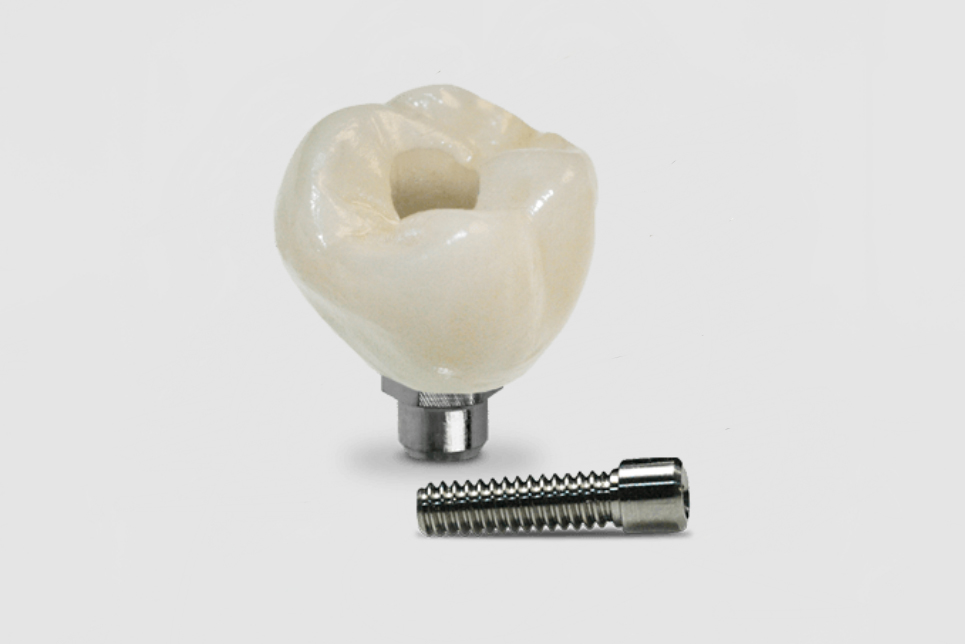 Implant Crown&Bridge (2).jpg