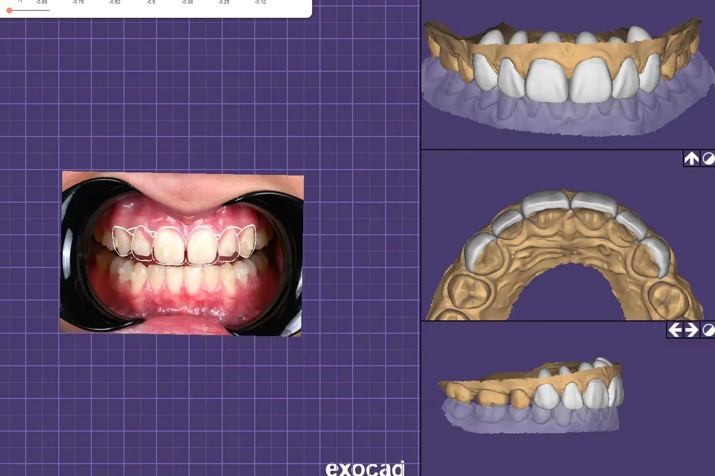 The Complete Workflow of a Digital Dental Lab (2).jpg