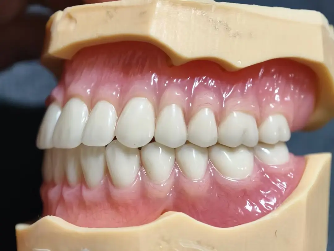 Chinese Dental Lab for High-Quality Dentures | Sunflower Dental Lab