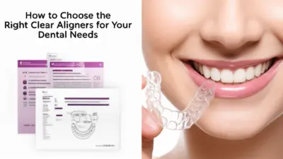 How to Choose the Right Clear Aligners for Your Dental Needs