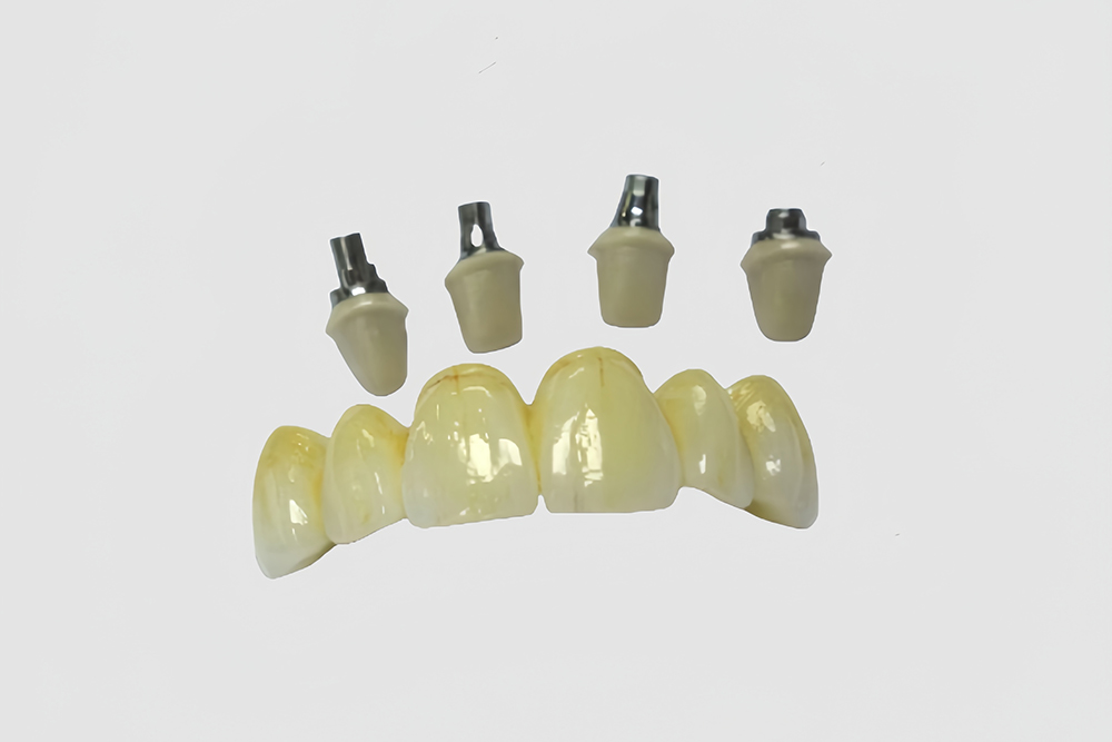 Implant Crown&Bridge (3).jpg