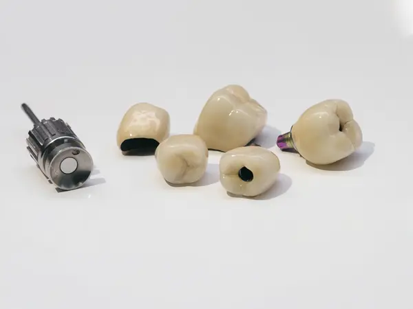 Implant Teeth